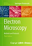 Electron microscopy: methods and protocols