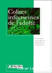 Colites infectieuses de l'adulte