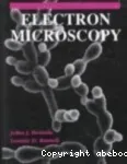 Electron microscopy. Principles and techniques for biologists